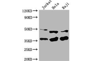 Western Blot Positive WB detected in: Jurkat whole cell lysate, Hela whole cell lysate, Raji whole cell lysate All lanes: NFKBIA antibody at 1:2000 Secondary Goat polyclonal to rabbit IgG at 1/50000 dilution Predicted band size: 36 kDa Observed band size: 36 kDa (NFKBIA anticorps  (AA 27-317))