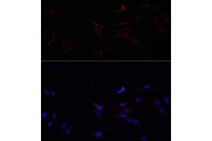 Immunofluorescence analysis of C6 cells using SUCLG1 antibody (ABIN7270623) at dilution of 1:100. (SUCLG1 anticorps  (AA 41-346))