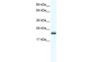 Western Blotting (WB) image for anti-Tubulin Polymerization Promoting Protein (Tppp) antibody (ABIN2461555) (Tppp anticorps)
