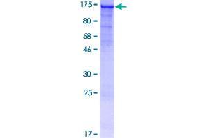 Image no. 1 for Tolloid-Like 2 (TLL2) (AA 1-1015) protein (GST tag) (ABIN1322850)