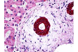 IHC Information: Paraffin embedded bileduct tissue, tested with an antibody dilution of 5 ug/ml. (Cytokeratin 19 anticorps  (N-Term))