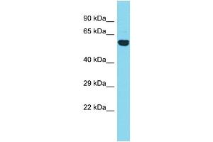 Host: Rabbit Target Name: CCDC149 Sample Type: Fetal Heart lysates Antibody Dilution: 1. (CCDC149 anticorps  (N-Term))