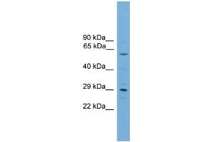 WB Suggested Anti-RPAIN  Antibody Titration: 0. (RPAIN anticorps  (C-Term))