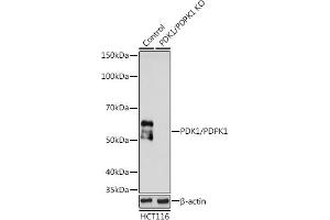 Western blot analysis of extracts from normal (control) and PDK1/PDPK1 knockout (KO) HCT116 cells, using PDK1/PDPK1 antibody (ABIN3022351, ABIN3022352, ABIN3022353, ABIN1681308 and ABIN6218755) at 1:1000 dilution.