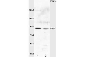 L1 rat kideny lysates L2 rat brain lysates probed with Anti E2F8 Polyclonal Antibody, Unconjugated (ABIN706106) at 1:200 overnight at 4 °C. (E2F8 anticorps)