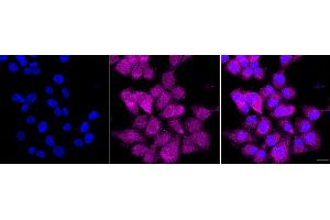 anti-Pyrophosphatase (Inorganic) 1 (PPA1) antibody