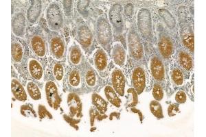 ABIN6257108 and ABIN6275023 at 1/100 staining human normal colon tissue by IHC-P.