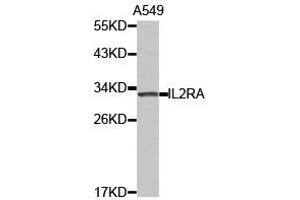 Western Blotting (WB) image for anti-Interleukin 2 Receptor, alpha (IL2RA) antibody (ABIN1873210) (CD25 anticorps)