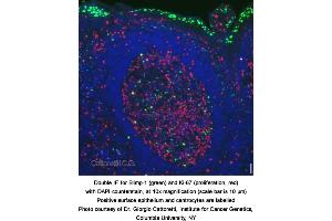 Image no. 2 for anti-PR Domain Containing 1, with ZNF Domain (PRDM1) (AA 199-409) antibody (ABIN363225)