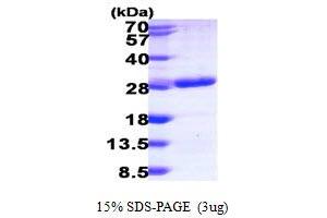 SDS-PAGE (SDS) image for RAB6B, Member RAS Oncogene Family (RAB6B) (AA 1-208) protein (His tag) (ABIN667354) (RAB6B Protein (AA 1-208) (His tag))
