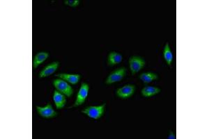 Immunofluorescent analysis of A549 cells using ABIN7167601 at dilution of 1:100 and Alexa Fluor 488-congugated AffiniPure Goat Anti-Rabbit IgG(H+L) (RGS2 anticorps  (AA 1-211))