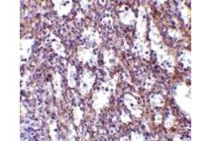 Immunohistochemistry (IHC) image for anti-Interleukin 32 (IL32) (C-Term) antibody (ABIN1030437)