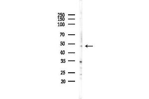 anti-A Kinase (PRKA) Anchor Protein 5 (AKAP5) (N-Term) antibody