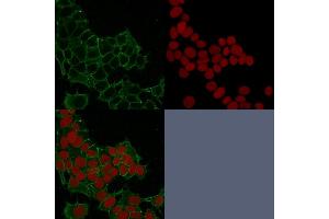 Confocal immunofluorescence image of HeLa cells using Catenin, gamma Mouse Monoclonal Antibody (11E4) Green (CF488) and Reddot is used to label the nuclei Red.