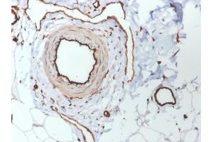 Formalin-fixed, paraffin-embedded human skin stained with CD31 Mouse Monoclonal Antibody (PECAM1/3530). (CD31 anticorps  (AA 625-738))