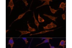 Immunofluorescence analysis of L929 cells using RPE Polyclonal Antibody at dilution of 1:100 (40x lens). (RPE anticorps)