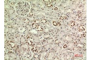 Immunohistochemistry (IHC) analysis of paraffin-embedded Human Kidney, antibody was diluted at 1:100.