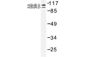 Image no. 1 for anti-Glutamate Receptor, Ionotropic, AMPA 2/3 (GRIA2/3) antibody (ABIN317945) (mGluR2/3 anticorps)