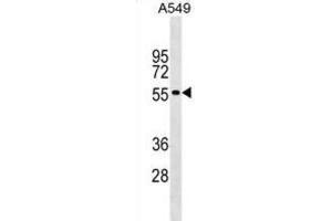Western Blotting (WB) image for anti-Gliomedin (GLDN) antibody (ABIN2999543) (GLDN anticorps)