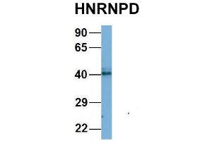 Host:  Rabbit  Target Name:  CHAD  Sample Type:  Human Adult Placenta  Antibody Dilution:  1.