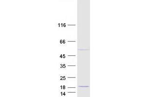 Validation with Western Blot