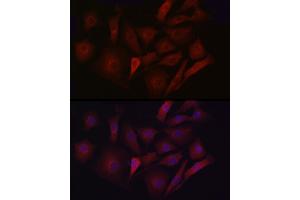 Immunofluorescence analysis of NIH/3T3 cells using LDL Receptor (LDLR) antibody (ABIN7268296) at dilution of 1:50.