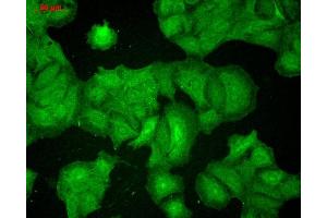 Immunocytochemistry/Immunofluorescence analysis using Mouse Anti-PSD95 Monoclonal Antibody, Clone 7E3 (ABIN361721 and ABIN361722).