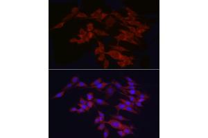Immunofluorescence analysis of PC-12 cells using WIF1 Rabbit pAb (ABIN6128927, ABIN6150218, ABIN6150220 and ABIN6221033) at dilution of 1:25 (40x lens). (WIF1 anticorps  (AA 29-220))