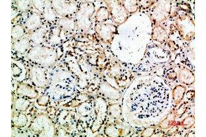 Immunohistochemical analysis of paraffin-embedded human-kidney, antibody was diluted at 1:200 (FCGR3A anticorps)