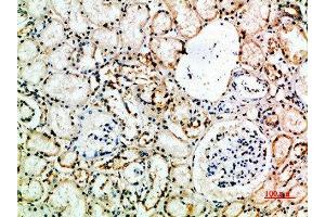 Immunohistochemical analysis of paraffin-embedded human-kidney, antibody was diluted at 1:200 (CD16a, CD16b (AA 100-150) anticorps)