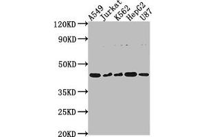 Western Blot Positive WB detected in: A549 whole cell lysate, Jurkat whole cell lysate, K562 whole cell lysate, HepG2 whole cell lysate, U87 whole cell lysate All lanes: DNASE2B antibody at 1:2000 Secondary Goat polyclonal to rabbit IgG at 1/50000 dilution Predicted band size: 42, 18 kDa Observed band size: 42 kDa (DNASE2B anticorps  (AA 68-281))