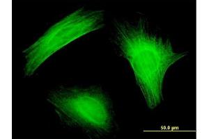 Immunofluorescence of monoclonal antibody to TWF1 on HeLa cell.