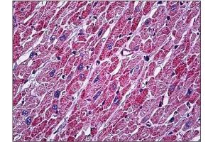 Human Heart: Formalin-Fixed, Paraffin-Embedded (FFPE)