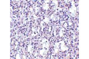 Immunohistochemistry of TBC1D10C in human spleen tissue with TBC1D10C polyclonal antibody  at 2. (Carabin anticorps  (N-Term))