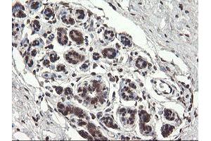 Immunohistochemical staining of paraffin-embedded Human breast tissue using anti-PNPO mouse monoclonal antibody. (PNPO anticorps)