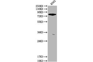 Western Blot Positive WB detected in: K562 whole cell lysate All lanes: ACSL6 antibody at 1:1000 Secondary Goat polyclonal to rabbit IgG at 1/50000 dilution Predicted band size: 78, 81, 75, 77, 80, 70 kDa Observed band size: 78 kDa (ACSL6 anticorps  (AA 214-484))