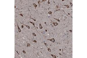 Immunohistochemical staining of human hippocampus with SLC25A38 polyclonal antibody  shows strong cytoplasmic positivity in neuronal cells at 1:50-1:200 dilution. (SLC25A38 anticorps)