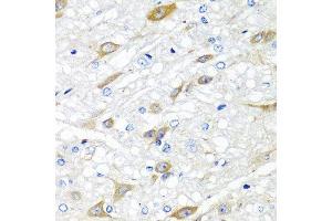 Immunohistochemistry of paraffin-embedded rat brain using CPA6 antibody at dilution of 1:100 (40x lens). (CPA6 anticorps)
