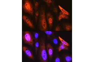 Immunofluorescence analysis of U-2 OS cells using J/CSN5/COPS5 Rabbit mAb (ABIN7266497) at dilution of 1:100 (40x lens).