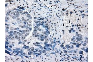 Immunohistochemical staining of paraffin-embedded colon tissue using anti-PRKYmouse monoclonal antibody. (PRKY anticorps)