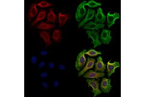 ABIN7094760 and ABIN7098811 staining Hela cells by IF/ICC.