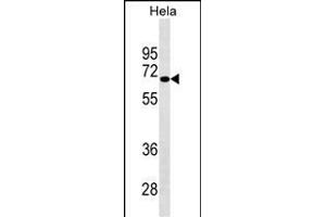 NUAK2 Antibody (ABIN1539841 and ABIN2843822) western blot analysis in Hela cell line lysates (35 μg/lane). (NUAK2 anticorps)