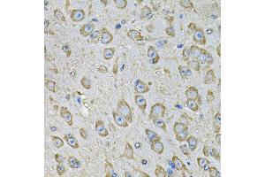 Immunohistochemistry of paraffin-embedded mouse brain using PDIA6 Antibody (ABIN5974243) at dilution of 1/100 (40x lens). (PDIA6 anticorps)