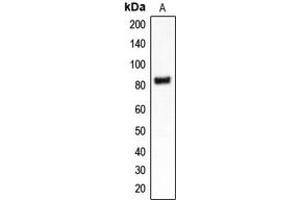 Western blot analysis of CLCN4 expression in MDAMB453 (A) whole cell lysates. (CLCN4 anticorps  (Center))