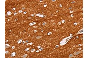 The image on the left is immunohistochemistry of paraffin-embedded Human brain tissue using ABIN7129824(IGSF8 Antibody) at dilution 1/15, on the right is treated with fusion protein. (IGSF8 anticorps)