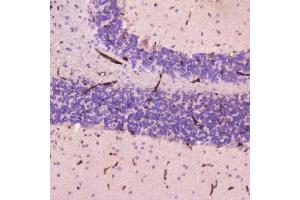 IHC analysis of C Reactive Protein using anti-C Reactive Protein antibody (ABIN5692861). (CRP anticorps  (AA 20-230))