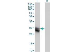 Western Blot analysis of CTHRC1 expression in transfected 293T cell line by CTHRC1 monoclonal antibody (M05), clone 1G12. (CTHRC1 anticorps  (AA 32-141))