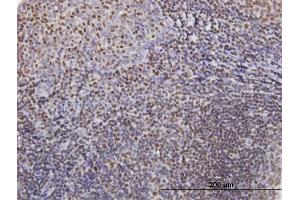 Immunoperoxidase of purified MaxPab antibody to IKZF3 on formalin-fixed paraffin-embedded human tonsil.