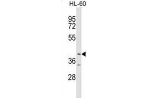 Western Blotting (WB) image for anti-Ankyrin Repeat and BTB (POZ) Domain Containing 1 (ABTB1) antibody (ABIN2999338) (ABTB1 anticorps)