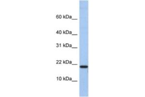 Western Blotting (WB) image for anti-C1D Nuclear Receptor Corepressor (C1D) antibody (ABIN2463344) (C1D anticorps)
